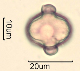 Red Clover (Trifolium pretense) Pollen Under the Microscope