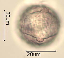Australian Honey Pollen Under the Microscope