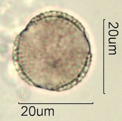 Washington State Honey Pollen
