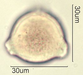 Washington State Honey Pollen