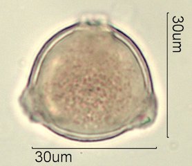 Washington State Honey Pollen