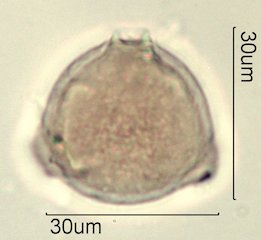 Washington State Honey Pollen