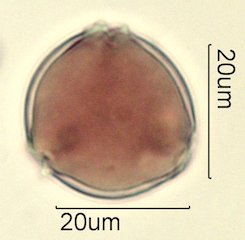 Washington State Honey Pollen