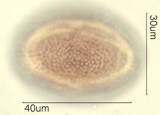 Washington State Honey Pollen
