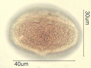 Washington State Honey Pollen