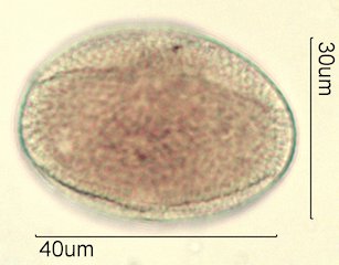 Washington State Honey Pollen
