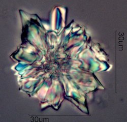 Wax Crystals from Honey