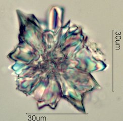 Wax Crystals from Honey