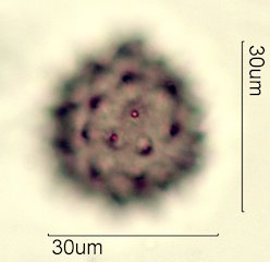 Washington State Honey Pollen Under the Microscope