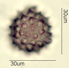 Washington State Honey Pollen Under the Microscope
