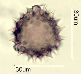 Washington State Honey Pollen Under the Microscope