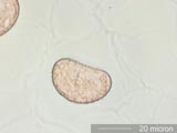 Fern Spore Under the Microscope