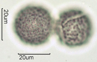 Western Buttercup (Ranunculus occidentalis) Pollen