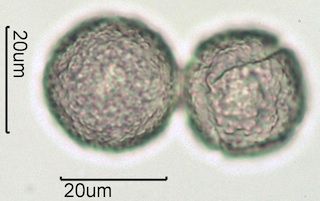 Western Buttercup (Ranunculus occidentalis) Pollen