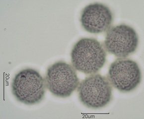 Western Buttercup (Ranunculus occidentalis) Pollen