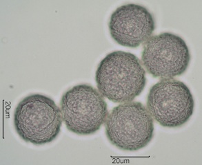 Western Buttercup (Ranunculus occidentalis) Pollen