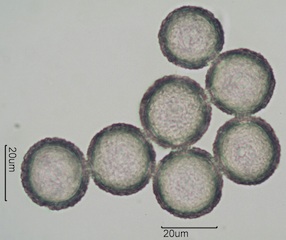 Western Buttercup (Ranunculus occidentalis) Pollen