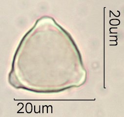 Ceanothus tomentosus Pollen Under the Microscope