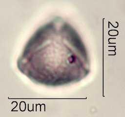 Ceanothus tomentosus Pollen Under the Microscope
