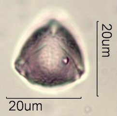 Ceanothus tomentosus Pollen Under the Microscope