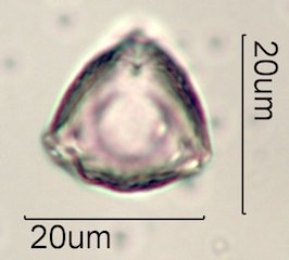 Ceanothus tomentosus Pollen Under the Microscope