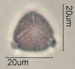 Ceanothus tomentosus Pollen Under the Microscope
