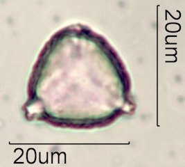Ceanothus tomentosus Pollen Under the Microscope