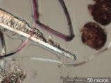 Hair Chewed by Carpet Beetle