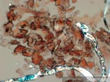 Carpet Beetle Frass
