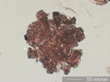 Carpet Beetle Frass