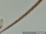 Carpet Beetle Caudal Hair