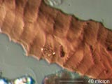 Insect Carapace Chewed by Carpet Beetle