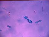 Sulfate Test