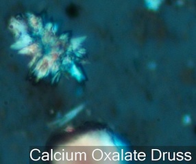 Calcium Oxalate Druss Phytolith
