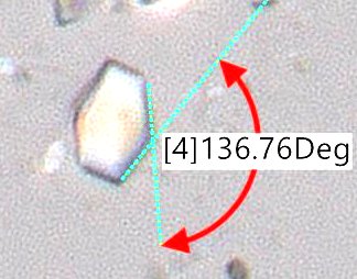 CaOx Angles