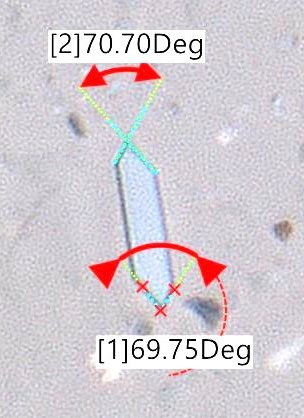 CaOx Angles