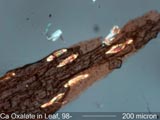 Calcium Oxalate In Leaf