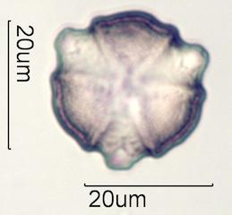 Cactus Honey Pollen Under the Microscope