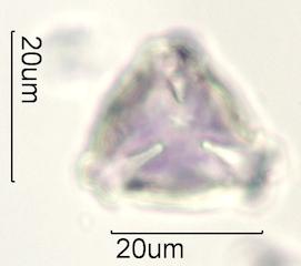 Cactus Honey Pollen Under the Microscope