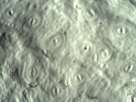 Stomata Under The Microscope