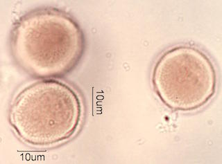 Trumpet Vine (Campsis radicans) Pollen