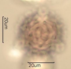 Canadian Honey Pollen Under the Microscope