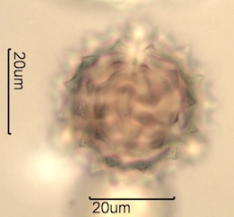 Canadian Honey Pollen Under the Microscope