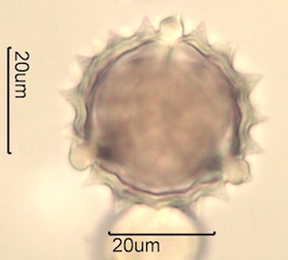 Canadian Honey Pollen Under the Microscope