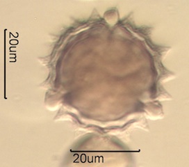 Canadian Honey Pollen Under the Microscope