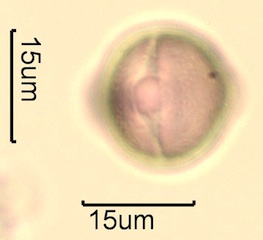Canadian Honey Pollen Under the Microscope