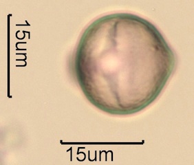 Canadian Honey Pollen Under the Microscope