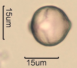 Canadian Honey Pollen Under the Microscope