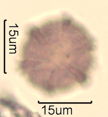 Canadian Honey Pollen Under the Microscope