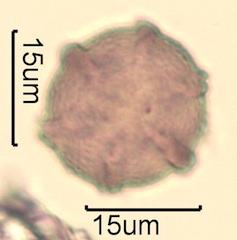 Canadian Honey Pollen Under the Microscope